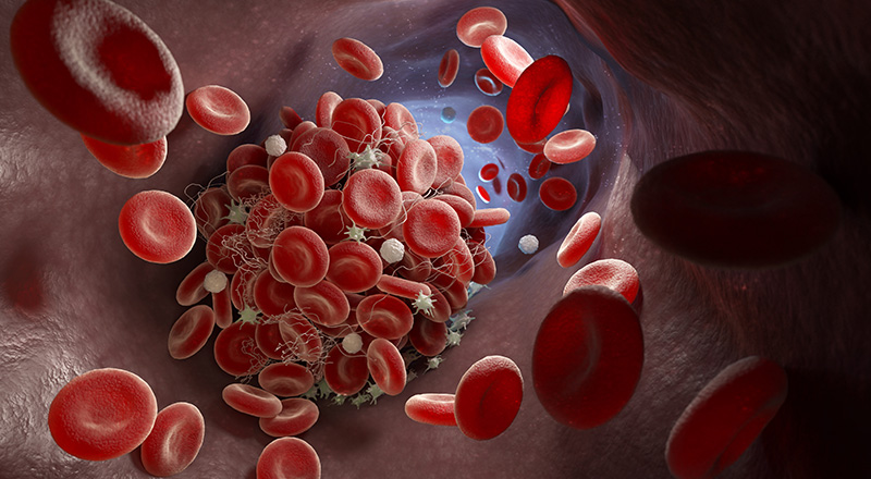 A blood clot and the flow of blood cells. Cannabis can effect blood cell development and function.